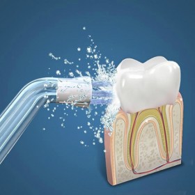 waterpulse-flosser4